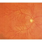 M82A EYE Examination Simulator (2 Steps)