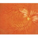 M82A EYE Examination Simulator (2 Steps)