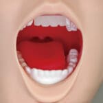 MW13 Difficult Airway Management Simulator Training Model