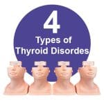 MW62 Thyroid Palpation Simulator