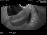Female Pelvic Ultrasound Phantom (Transvaginal and Transabdominal) Gynecology US-10
