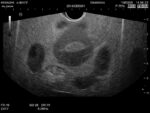 Female Pelvic Ultrasound Phantom (Transvaginal and Transabdominal) Gynecology US-10