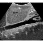 Ultrasound Examination Training Phantom ECHOZY US-1
