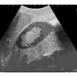 Ultrasound Examination Training Phantom ECHOZY US-1