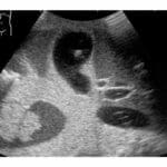 Ultrasound Examination Training Phantom ABDFAN US-1B