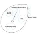 Breast Ultrasound Examination Phantom BREAST FAN US-6