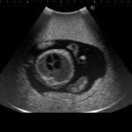 Fetus Ultrasound Examination Phantom SPACE FAN ST US-7A