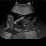 Fetus Ultrasound Examination Phantom SPACE FAN ST US-7A