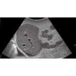 Pediatric FAST Acute Abdomen Phantom US-8