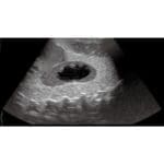 Pediatric FAST Acute Abdomen Phantom US-8