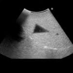 Fundamental Ultrasound Phantom US18