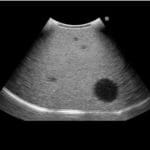 Fundamental Ultrasound Phantom US18