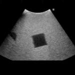 Fundamental Ultrasound Phantom US18