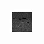 US-21 DVT (Deep Vein Thrombosis) Phantom
