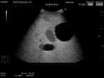 Female Pelvic Ultrasound Phantom (Transvaginal and Transabdominal) Gynecology US-10