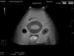 Female Pelvic Ultrasound Phantom (Transvaginal and Transabdominal) Gynecology US-10