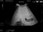 Female Pelvic Ultrasound Phantom (Transvaginal and Transabdominal) Gynecology US-10