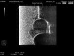 Infant Hip Sonography Training Phantom US-13