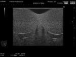 Scrotal Ultrasound Phantom US-11