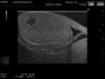 Scrotal Ultrasound Phantom US-11