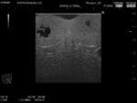 Scrotal Ultrasound Phantom US-11