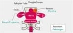 Female Pelvic Ultrasound Phantom (Transvaginal and Transabdominal) Gynecology US-10