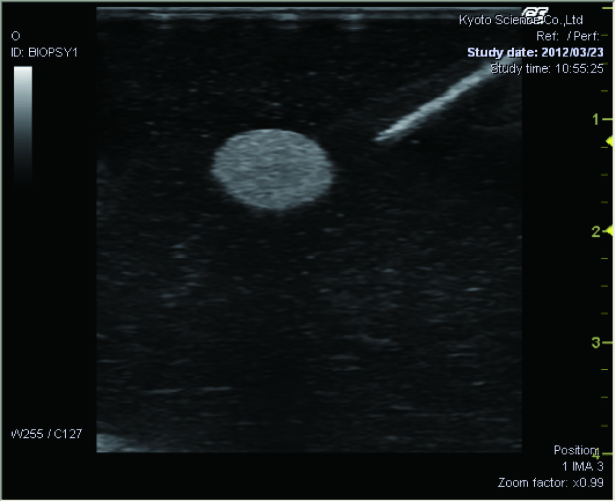 Ultrasound Guided Breast Biopsy Training Model - Duo (Transparent and Opaque) set US-9