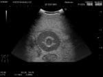 Female Pelvic Ultrasound Phantom (Transvaginal and Transabdominal) Gynecology US-10