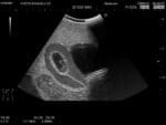 Female Pelvic Ultrasound Phantom (Transvaginal and Transabdominal) Gynecology US-10