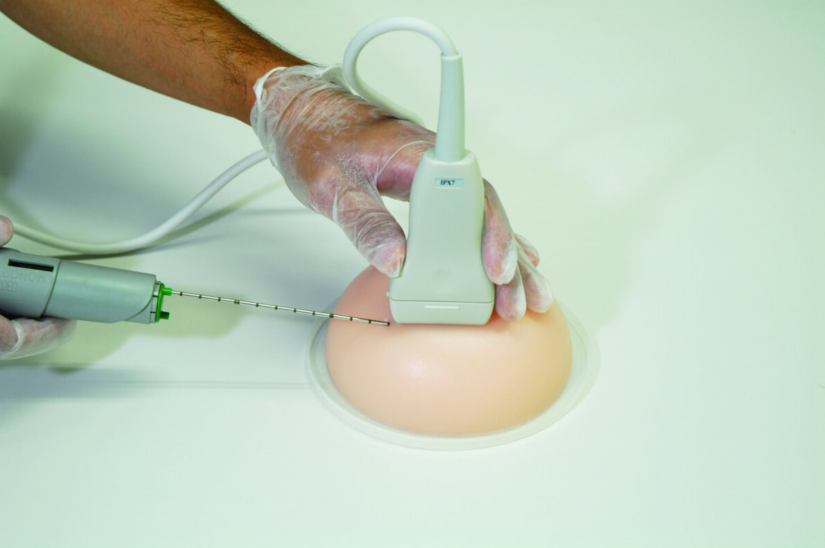 Ultrasound Guided Breast Biopsy Training Model - Duo (Transparent and Opaque) set US-9