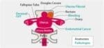 Female Pelvic Ultrasound Phantom (Transvaginal and Transabdominal) Gynecology US-10